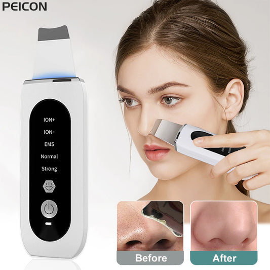 Ultrasonic Skin Scrubber Blackhead Remover